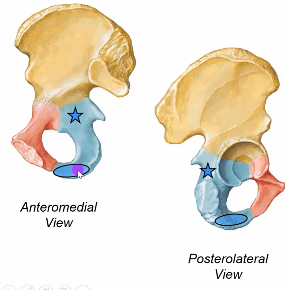 The image shows two views of the human pelvis, specifically the anteromedial and posterolateral views. The pelvis is depicted in a detailed illustration, with the ilium, ischium, and pubis bones colored in shades of yellow, blue, and red. Two blue stars indicate specific points on each view, while two blue ovals highlight areas at the bottom of each pelvis. A purple section is visible within the oval on the anteromedial view.