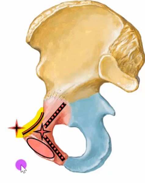 This image depicts a detailed illustration of the human pelvis, with various sections highlighted in different colors. The top portion of the pelvis is rendered in a light brown hue, while the lower sections are colored in pink, blue, and yellow. The image features a white background and includes a small purple circle with a cursor icon in the bottom-left corner. A starburst design element is also present, adding a touch of visual flair. Overall, the image appears to be a medical illustration, likely used for educational or instructional purposes.