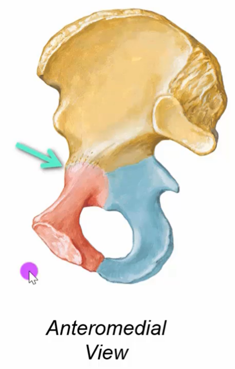 The image shows a detailed illustration of the human pelvis from an anteromedial view. The pelvis is divided into three sections, with the top portion colored in a light brown hue, the lower right section in blue, and the lower left section in red. A green arrow points to the area where the red and brown sections meet. The background of the image is white, and the words 'Anteromedial View' are written in black text at the bottom. The image appears to be a medical illustration, likely used for educational purposes.