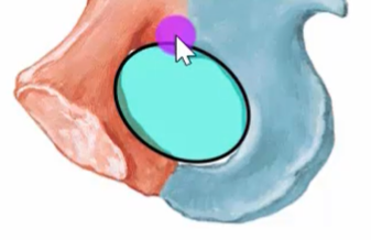 An illustration of a human hip joint with a large teal oval shape overlaid on it, accompanied by a purple circle and a white mouse cursor.